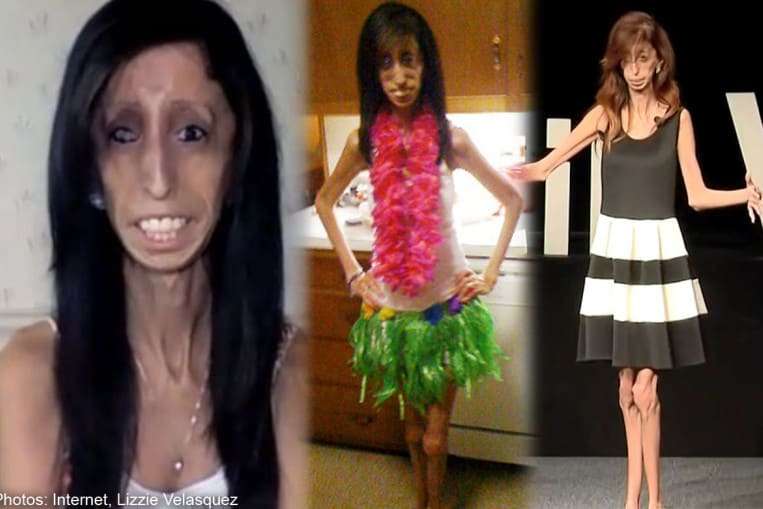 Lizzie Velásquez story 2022