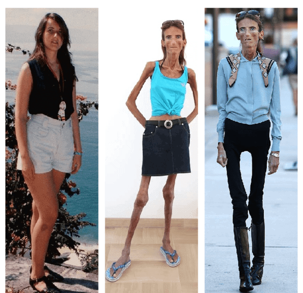 Meet The Woman Deemed The World's Skinniest Living Person